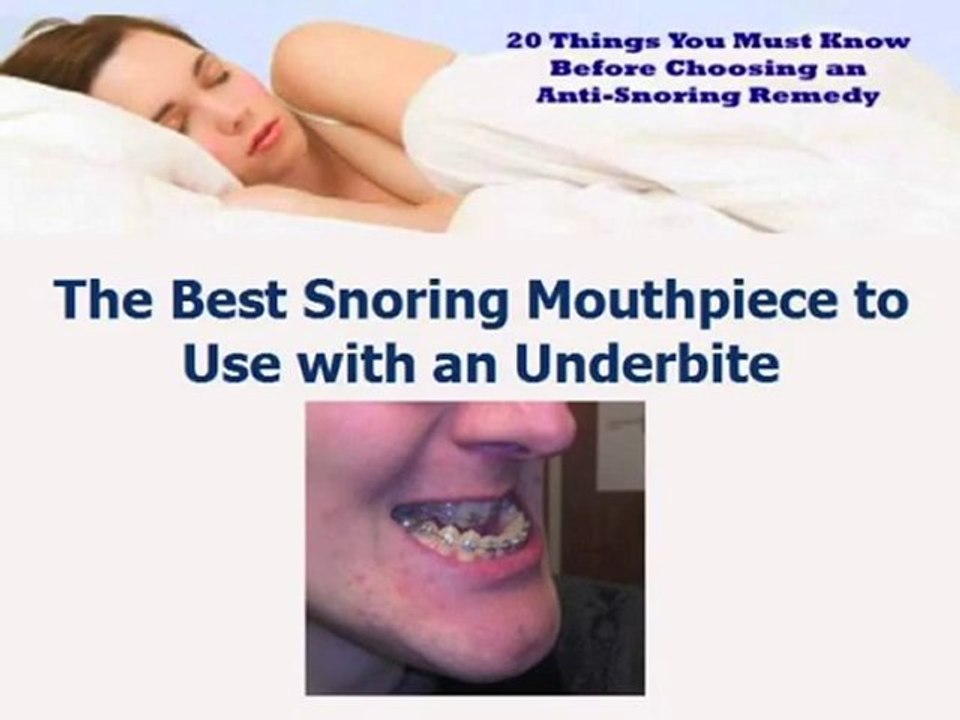 Watch This before Choosing a Snore Mouthpiece for an Underb