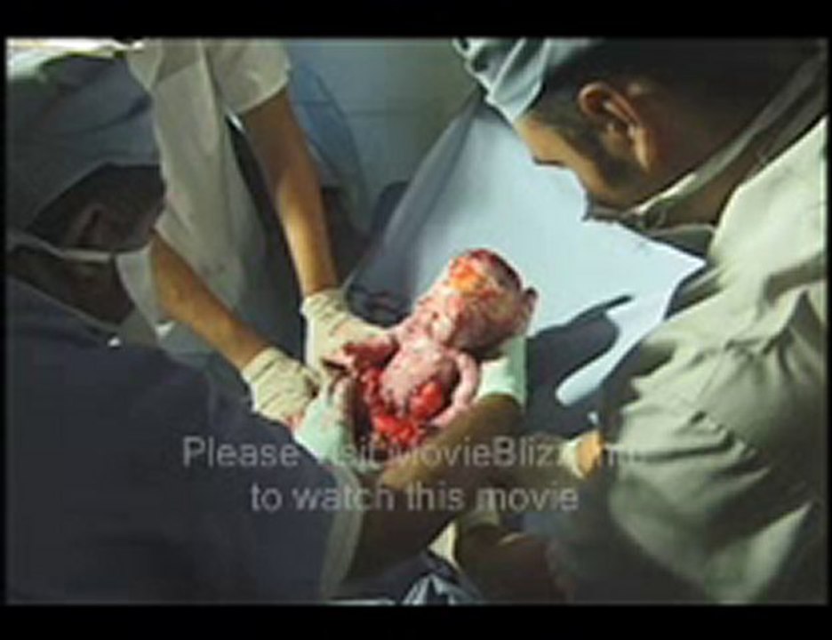 Fetus (2008) part 1 of 15.