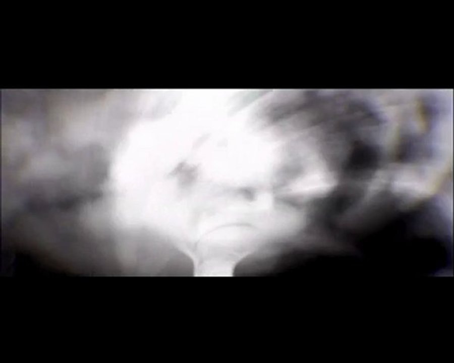 Venetian Snares - Szamar Madar - Breakcore