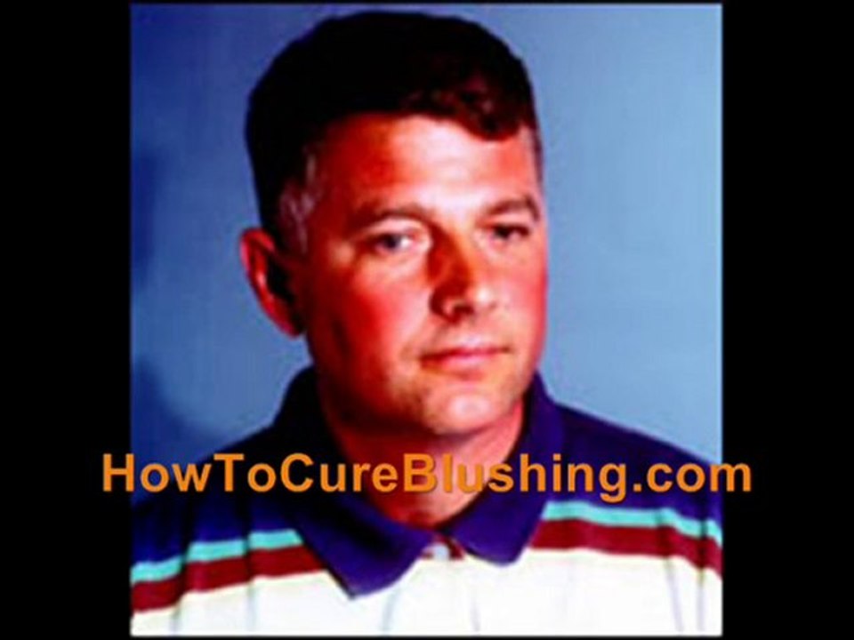 Treatment For Facial Blushing