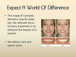 Cosmetic Dentistry Mesa AZ - Cosmetic Dentist Mesa AZ