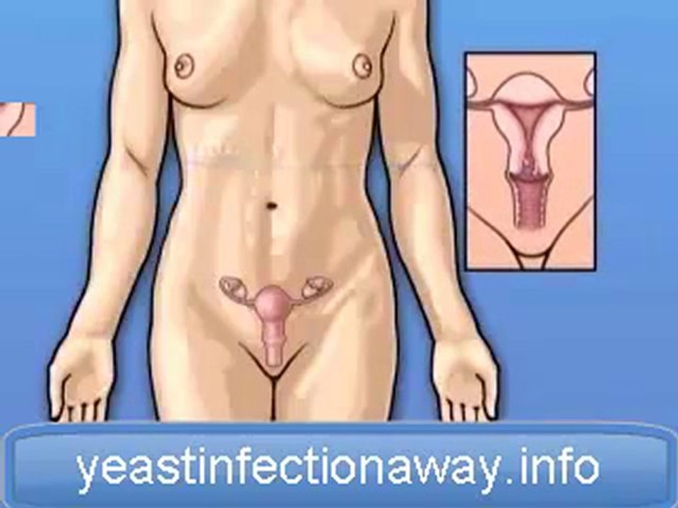 candida bacteria,anti candida diet,candida diet ...