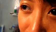 Eye