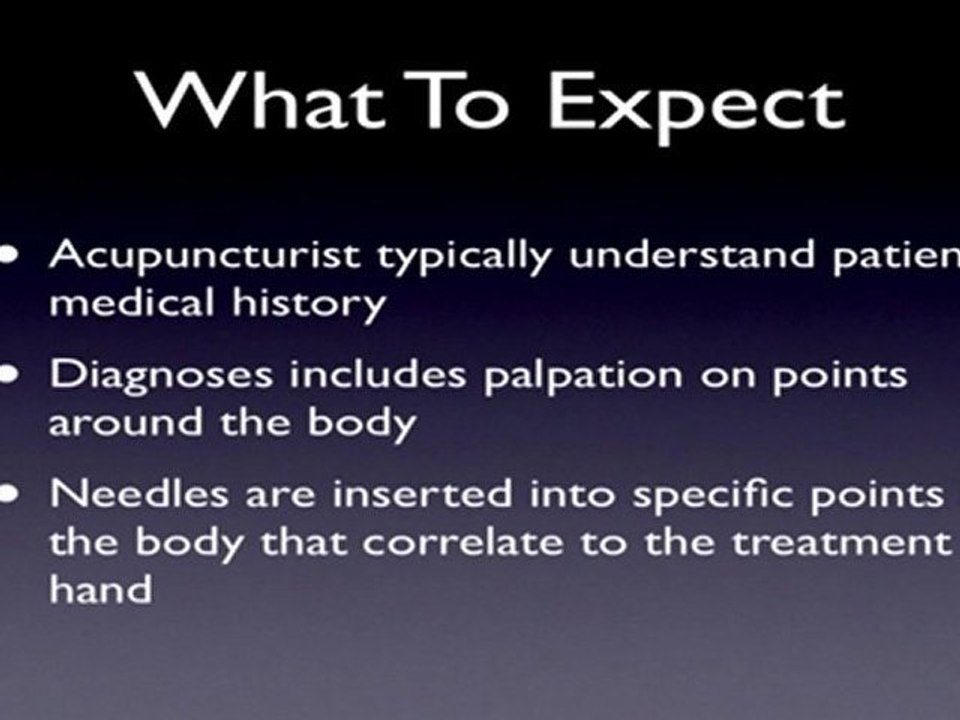 Acupuncture San Francisco - 3 Basic Questions About Acupunc