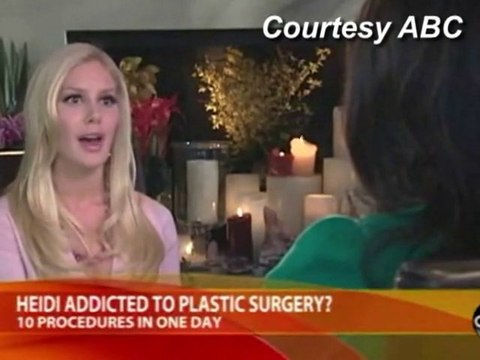 SNTV - Heidi Montag's new face