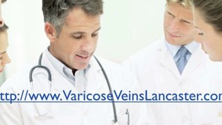 Varicose Vein Treatment Lancaster PA, Best Varicose Vein Re