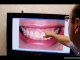 Doylestown Cosmetic Dentistry – Philadelphia Smile Makeover