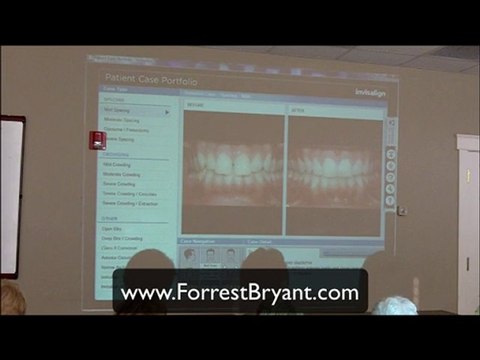 Huntsville Dentist, Invisalign, Teeth Whitening Video 4