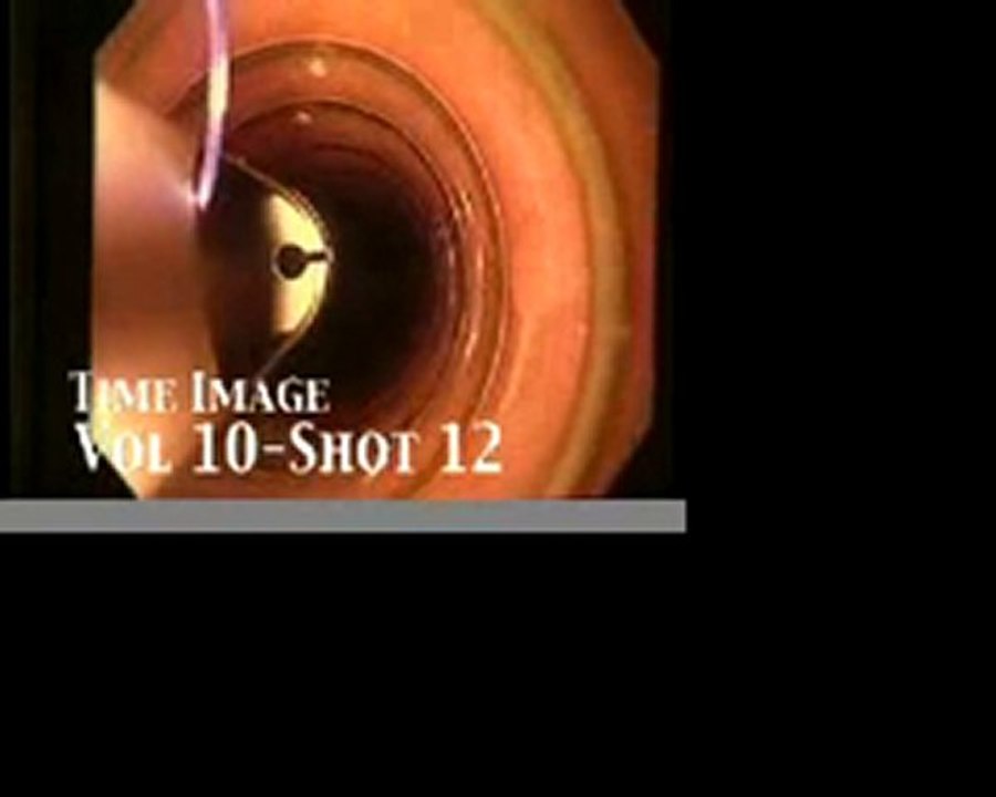 Medicine Stock Footage Vol 10 PublicDomainFootage.com