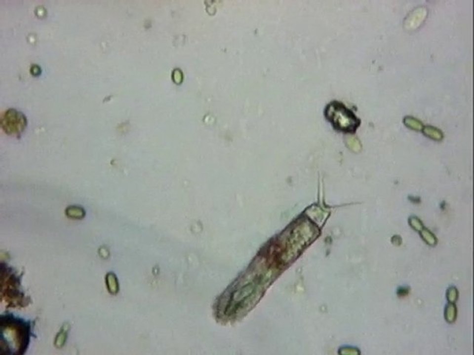 Un rotifère, famille des dicranophoridae ?