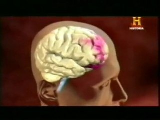 Conmocion cerebral: Futbol americano (Cascos de proteccion)