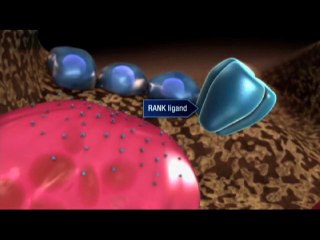 Treating Osteoporosis