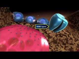 Traiter l’ostéoporose