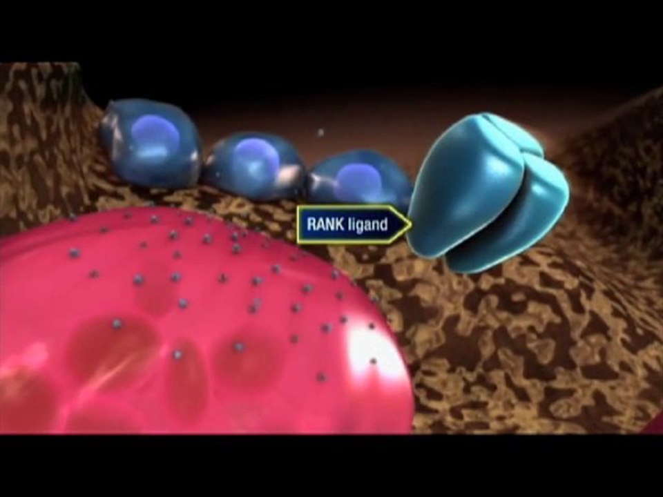 Traiter l’ostéoporose