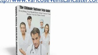 Choose Varicose Veins Removal Treatment Methods in Lancaste