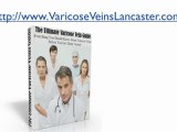 Choose Varicose Veins Removal Treatment Methods in Lancaste