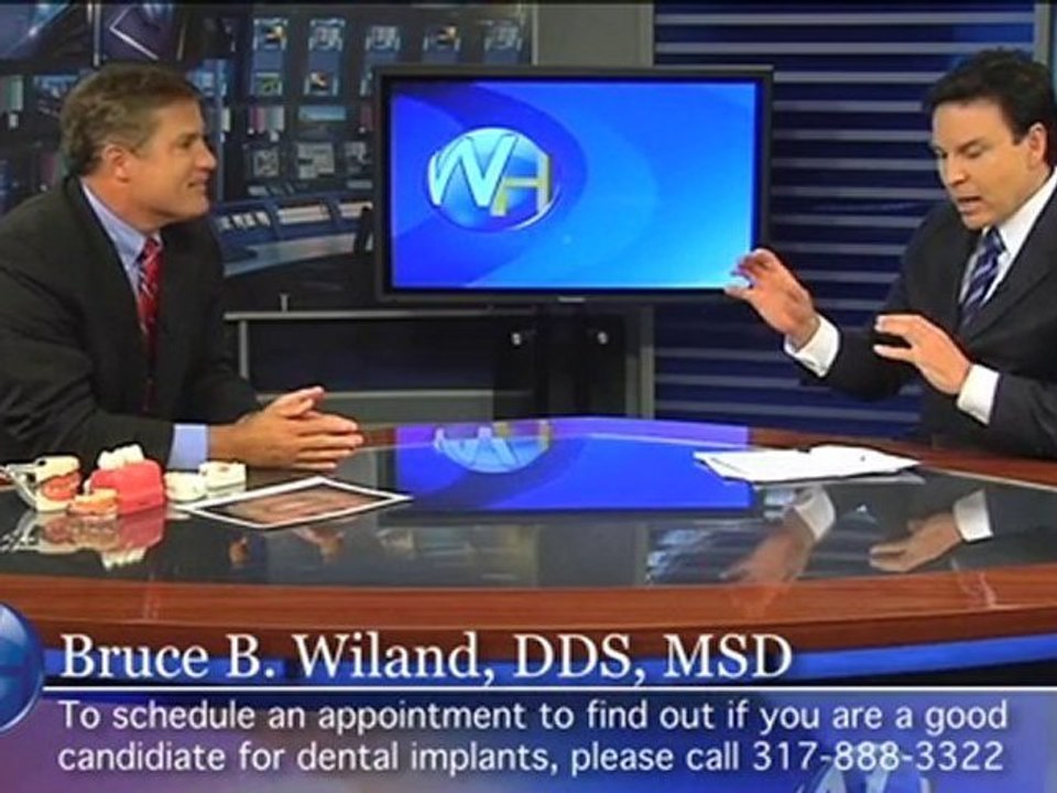 Indianapolis Dental Implants