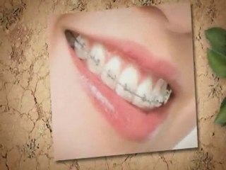 Dentists Arlington Va:Do I Need Braces