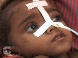 Encephalitis Claims Several Lives in Northern India
