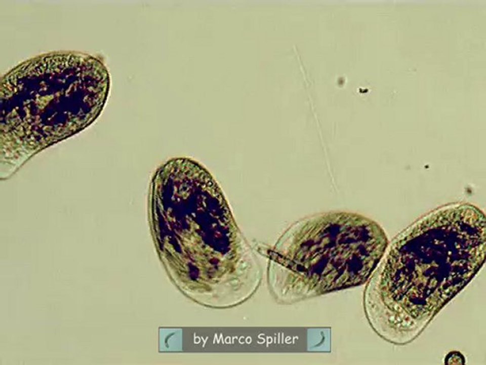 Chilodonella cucullus