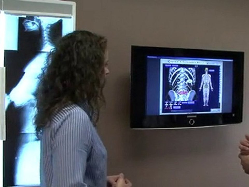 Irvine Chiropractor - Lee Chiropractic - Vertigo