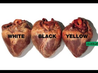 Morandi - Angel (DJ SRKN Full Club Mix)