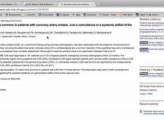 Varicose Vein Doctor Consultations and Information