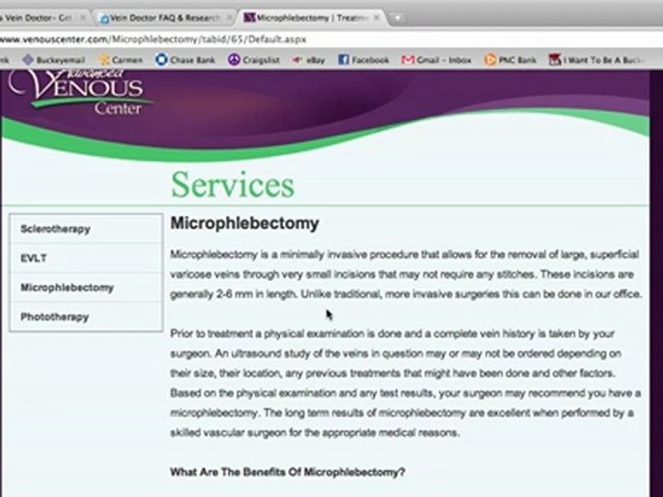 Varicose Vein Doctor Consultations and Information