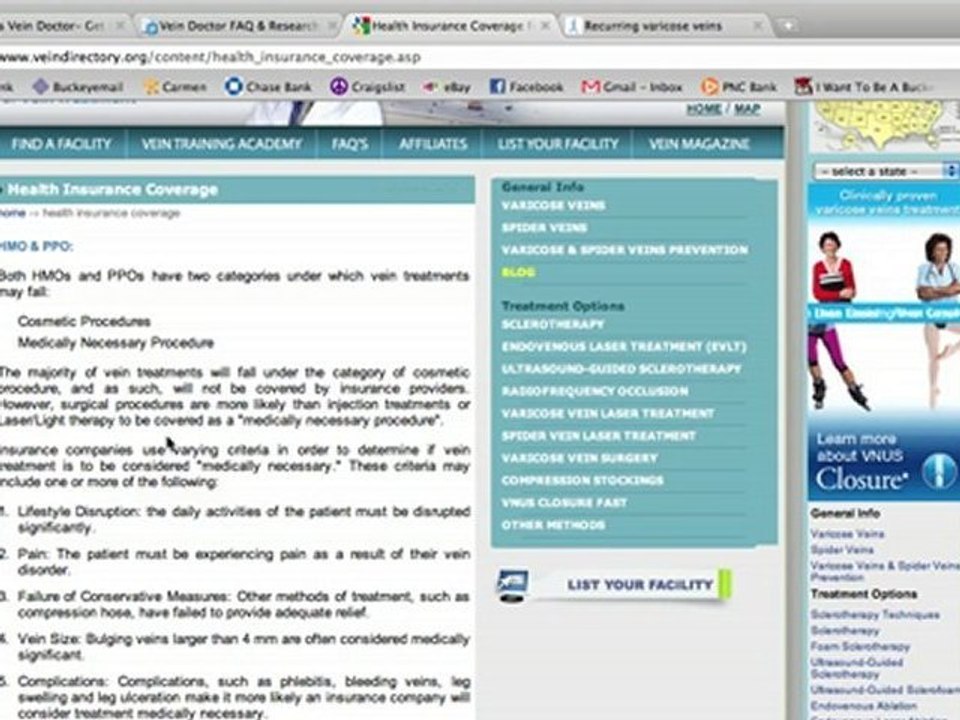 Varicose Vein Doctor Consultations and Information