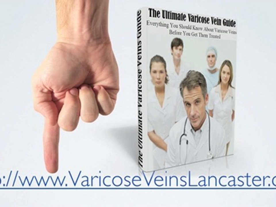 Lancaster PA Varicose Vein Removal Treatment,  Varicose Sur