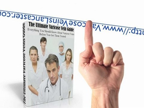 Find Varicose & Spider Vein Removal Treatments in Lancaster