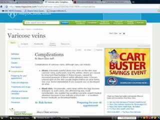 Varicose Vein Doctor Consultations and Information