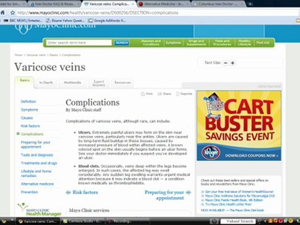Varicose Vein Doctor Consultations and Information