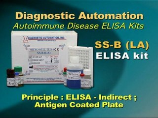 SS-B (La) ELISA test kit | FDA-CE | 818-591 3030-USA.