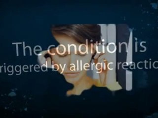 Dyshidrotic Eczema and Its Cures