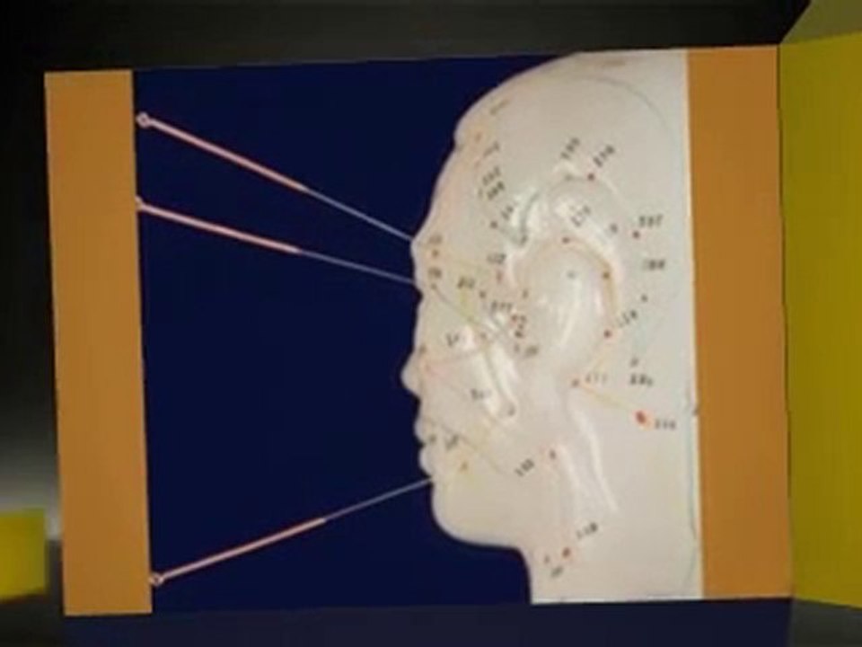 Acupuncture Near Reading