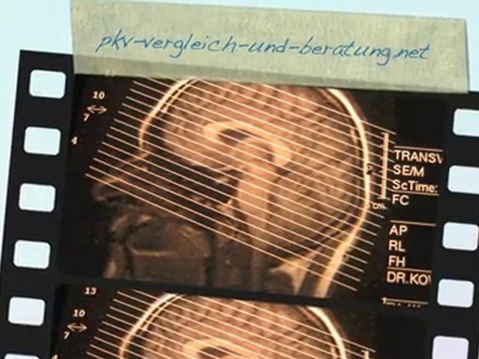 PKV Vergleich - Private Krankenversicherung Vergleich