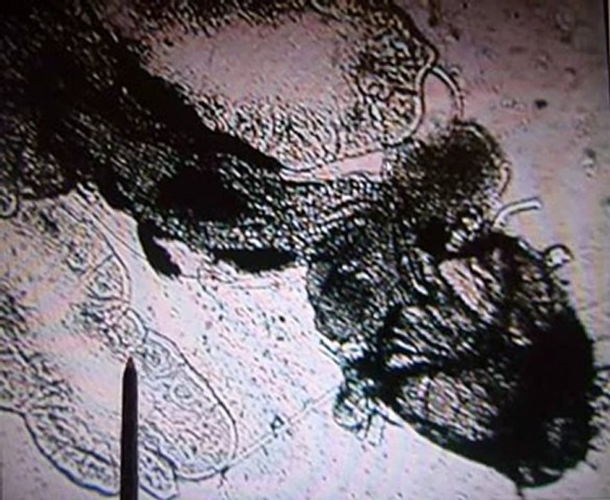 Observation des chromosomes géants de Chironomes