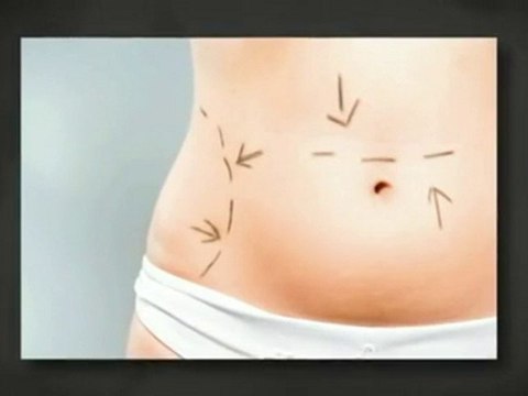 Long Island Plastic Surgery-Best Plastic Surgery on Long Is