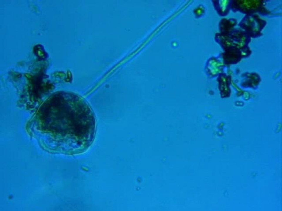 Vorticelle vitesse normale et ralenti