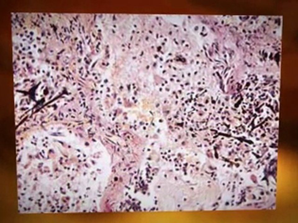 Asbestos Removal Contractor San Buenaventura CA