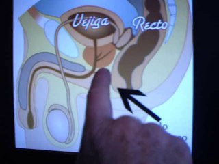 Eyaculacion precoz La mentira de Kegel