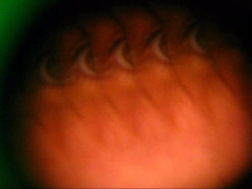 Snoyer