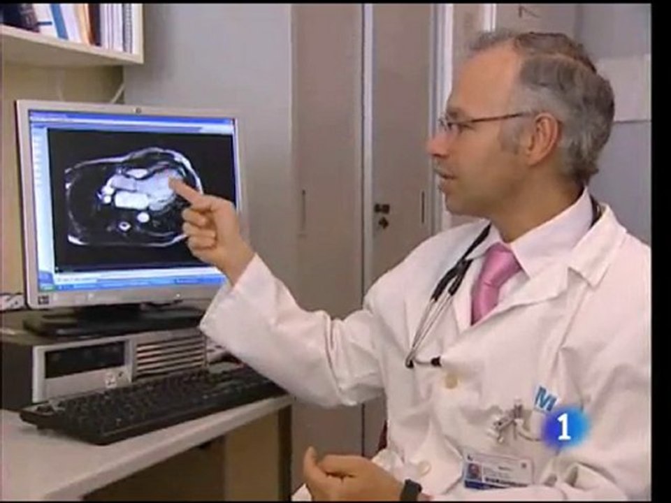 Riesgo cardiovascular