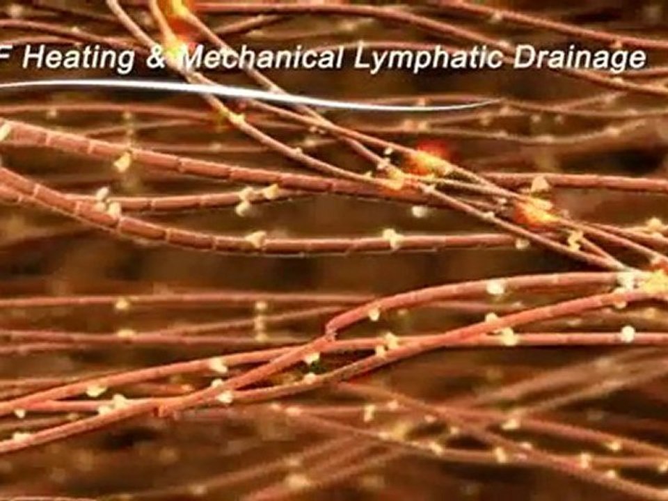 Accent ultra animation