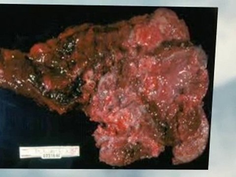 Asbestos Abatement Murrieta CA