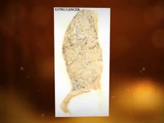 Asbestos Exposure Salinas CA