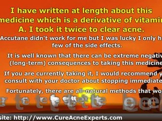 Using Vitamin A to Treat and Prevent Acne