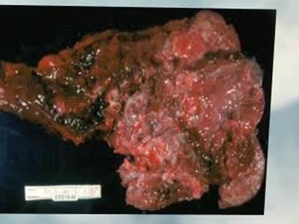 Asbestos Abatement Long Beach CA