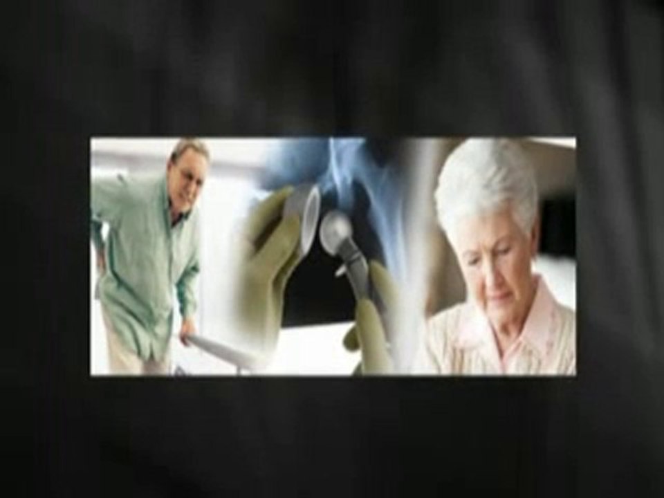 Depuy Hip Recall Lawyers